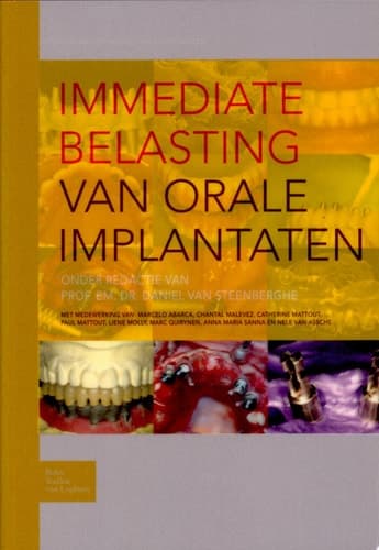 Immediate belasting van orale implantaten
