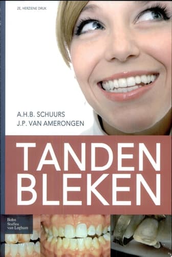 Tanden bleken