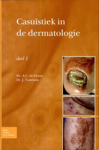Casuïstiek in de dermatologie deel I