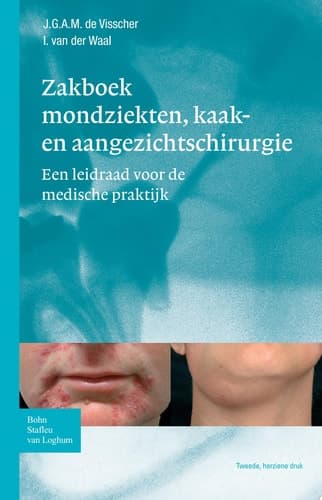 Zakboek Mondziekten, Kaak- En Aangezichtschirurgie Een Leidraad Voor de Medische Praktijk