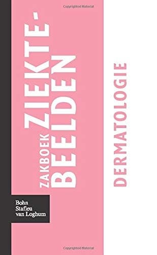 Zakboek ziektebeelden - Dermatologie