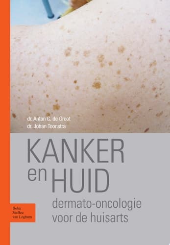 Kanker en Huid Dermato-Oncologie Voor de Huisarts