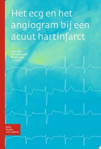 Het ecg en het Angiogram bij een Acuut Hartinfarct