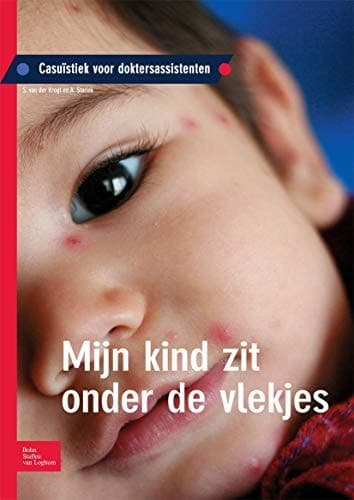 Mijn kind zit onder de vlekjes Casuïstiek voor doktersassistenten
