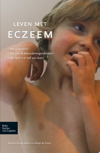 Leven met eczeem