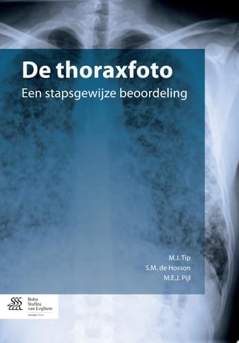 De thoraxfoto een stapsgewijze beoordeling