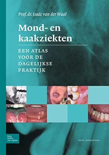 Mond- en kaakziekten Een atlas voor de dagelijkse praktijk