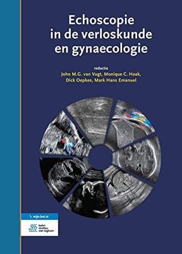 Echoscopie in de verloskunde en gynaecologie (Dutch Edition)