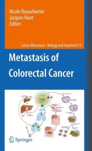 Metastasis of Colorectal Cancer