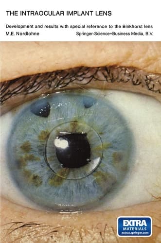 The Intraocular Implant Lens Development and Results with Special Reference to the Binkhorst Lens: Proefschrift