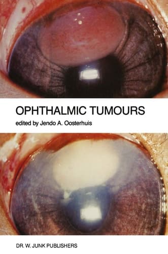 Ophthalmic Tumours: Including lectures presented at the Boerhaave Course on “Ophthalmic Tumours” of the Leiden Medical Faculty, held in Leiden, The ... 2–3, 1984 (Monographs in Ophthalmology, 9)
