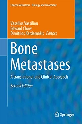 Bone Metastases A translational and Clinical Approach