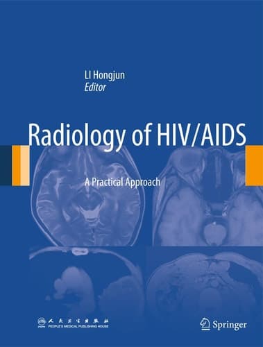 Radiology of HIV/AIDS A Practical Approach