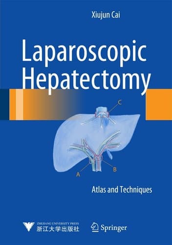 Laparoscopic Hepatectomy Atlas and Techniques