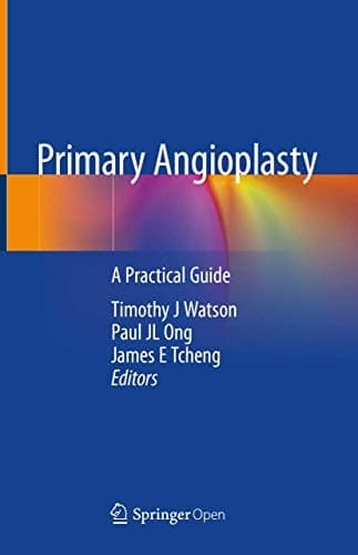Primary Angioplasty A Practical Guide